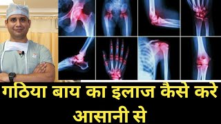 गठिया बाय का पूरा इलाज सरल हिंदी में पहली बार complete information of Rheumatoid Arthritis [upl. by Crispen]