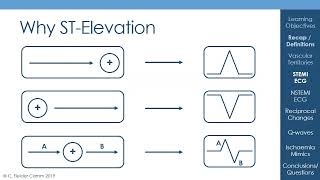 Understanding the ECG Lecture 2  Ischaemia and Infarction [upl. by Vacuva]