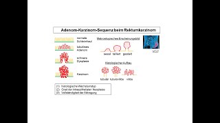 AdenomKarzinomSequenz beim Rektumkarzinom  Strahlentherapie Prof Hilke Vorwerk [upl. by Dincolo]