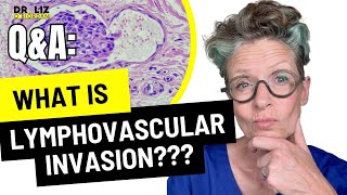 What is Lymphovascular Invasion  Breast Cancer  Dr Liz ORiordan [upl. by Leggett]