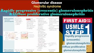 Rapidly progressive crescentic glomerulonephritis amp Diffuse proliferative glomerulonephritis [upl. by Neeloj]