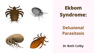 Ekbom Syndrome  Delusional Parasitosis [upl. by Tyra]