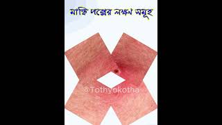 মাংকিপক্সের লক্ষণ সমূহ। মাংকিপক্স হলে বুঝার উপায়। monkeypoxvaccine [upl. by Devora]