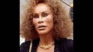 Jocelyn Wildenstein From Beginning To Now 02 [upl. by Terle]