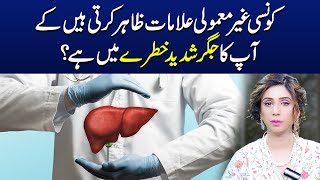 Unusual Symptoms That Indicate Your Liver Is in Serious Danger  Dr Sahar Chawla [upl. by Yllatan]