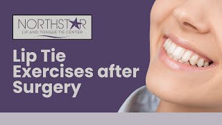 Lip Tie Exercises after Surgery child and adult [upl. by Brazee]