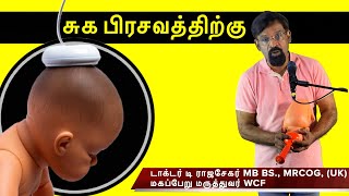 சுகப்பிரசவத்துக்கு Vaccum டெலிவரி  when we need Vacuum for delivery of your baby [upl. by Erleena]