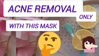 Acne removal only with this mask [upl. by Ahsinrats]