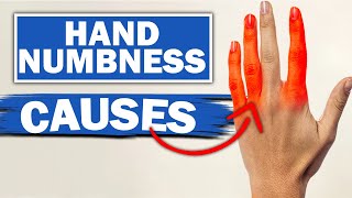 Expert Reveals MindBlowing Facts About Numbness amp Tingling In Fingers [upl. by Adamson]