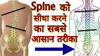 Acupressure Point For SCOLIOSIS  Back Pain Relief  Magical One Point  In Hindi [upl. by Munn]