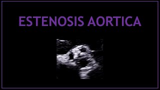 Estenosis Aortica Ecocardiografia  Cardiologia [upl. by Alliehs]