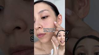 How I repaired my skin barrier in 1 week [upl. by Sivaj]