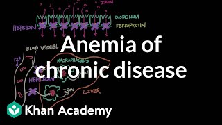 Anemia of chronic disease  Hematologic System Diseases  NCLEXRN  Khan Academy [upl. by Alan]