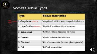 Necrosis 1 Coagulative [upl. by Carmella174]