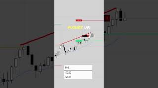 Wedge Top Scalp [upl. by Hyman]