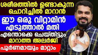 ശരീരത്തിൽ ഉണ്ടാകുന്ന ചൊറിച്ചിൽ മാറാൻ ഈ ഒരു വിറ്റാമിൻ എടുത്താൽ മതി [upl. by Harli]