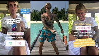 Justin Bieber trying to be doctor to his mom Pattie Mallette injured leg in Maldives  January 2018 [upl. by Mignonne698]