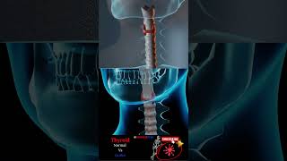 Goiter vs Normal Thyroid [upl. by Rucker]