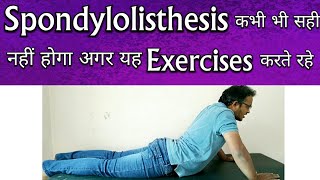 Spondylolisthesis Exercises  Exercises To AVOID For Spondylolisthesis TREATMENT [upl. by Jemmy640]