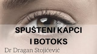 Botoks i spušteni kapci [upl. by Lapo]