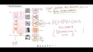 Pemphigus vulgaris vs Bullous pemphigoidEpithelial cell junctions [upl. by Arundell]