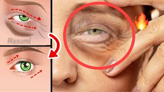 5mins Eye Lifting Exercise For Eye Wrinkles Dark Circle Eye Bags Under Eyes [upl. by Niwroc]