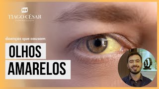 O QUE CAUSA OS OLHOS AMARELOS [upl. by Coffey25]