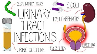 UTI Made Easy  Urinary Tract Infections Explained Clearly [upl. by Older]