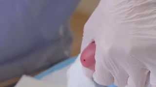 CLSI Newborn Screening DVD  Informational Video Trailer [upl. by Behlke]