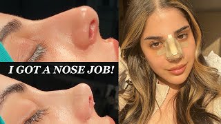 I GOT A NOSE JOB IN TURKEY WITH THE BEST SURGEON  PART 1  CLINICHUB [upl. by Yirinec304]