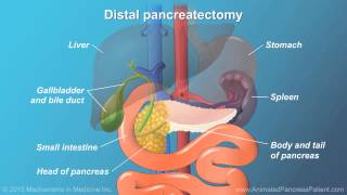 Pancreatic Surgery Benefits Risks and Relevant Anatomy [upl. by Silera]