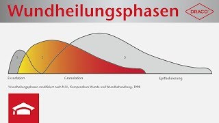 Wundheilungsphasen im Überblick  Exsudationsphase Granulationsphase Epithelisierungsphase [upl. by Lebar]