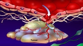 Introduction to Cancer Biology Part 4 Angiogenesis [upl. by Acir]