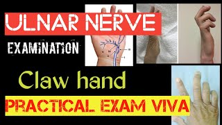 Examination of Ulnar nerve nerveorthopedicspractical exam clawhand [upl. by Mandych497]