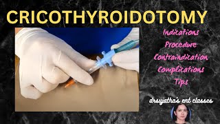 205cricothyroidotomy cricothyrotomy procedure airway emergency stridor [upl. by Oribelle]