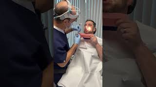 ￼ nasal splint removal six days after septoplasty endoscopic sinus surgery [upl. by Jayme]