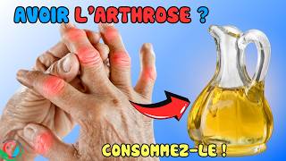 Mangez MAINTENANT  Top 6 Aliments Pour LUTTER CONTRE LArthrose Des MAINS  Allez Santé [upl. by Puklich]