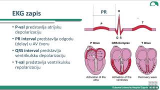 EKG i aritmije ZVU 1 dio [upl. by Bohun]