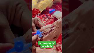 Intravenous IVcannulation । Cannulation Technique । Vgo kaise Lagaye ।। cannulation ivinjection [upl. by Letta]