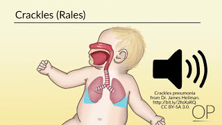 Respiratory Assessment by B Leary L DelSignore  OPENPediatrics [upl. by Aldos]