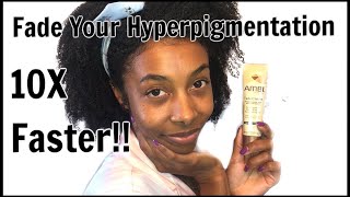 How To REALLY Use Ambi Fade Cream  Fade Hyperpigmentation [upl. by Ecirrehs230]