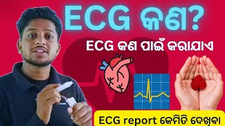 Electrocardiographକଣ  କଣ ପାଇଁ କରାଯାଏ How ECG done  ECG report heart ❤️ rate  ECG graph [upl. by Fisa425]