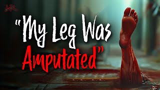 quotMy Leg Was Cut Offquot  Real Disturbing 911 Calls [upl. by Trauts]