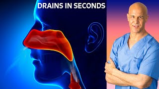 Dr Mandells Sinus Drainage Trick [upl. by Niran]