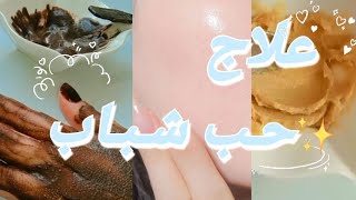 علاج حب الشباب و آثاره بسرعة و بأقل ثمن احصلي على بشرة زجاجية مشرقة مثل الكوريات ✨ [upl. by Rene]