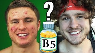 Vitamin B5 The Secret To Clearing Acne [upl. by Dazhahs]