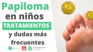 Papiloma en los pies de los niños y su tratamiento en Clínicas H3 [upl. by Sakmar542]