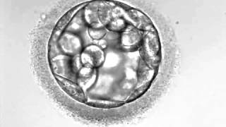 Development of hatching Embryo blastocyst stage [upl. by Keryt]