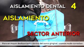 AISLAMIENTO ABSOLUTO DEL FRENTE ANTERIOR para odontología restauradora endodoncia y estética dental [upl. by Lothaire85]