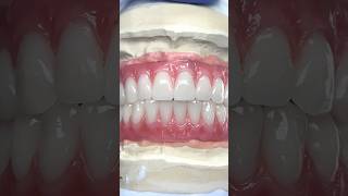 Hybrid ScrewRetained TryIn lsk121shorts dentistry teeth [upl. by Akirdnuhs]